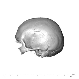 NGA88 SK660 Homo sapiens cranium lateral left