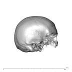 NGA88 SK660 Homo sapiens cranium lateral right