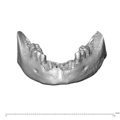 NGA88 SK708 Homo sapiens mandible dentition anterior
