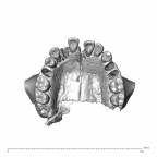 NGA88 SK708 Homo sapiens maxilla dentition inferior