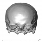 NGA88 SK72 Homo sapiens cranium anterior