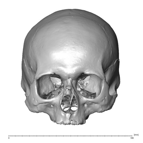 NGA88 SK742 Homo sapiens cranium anterior
