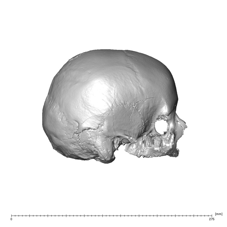 NGA88 SK749 Homo sapiens cranium lateral right