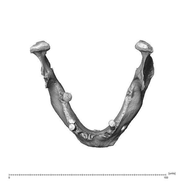NGA88 SK749 Homo sapiens mandible superior