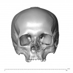 NGA88 SK750 Homo sapiens cranium anterior