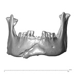 NGA88 SK766 Homo sapiens mandible anterior