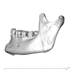 NGA88 SK766 Homo sapiens mandible lateral left