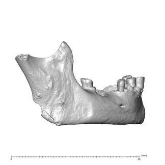 NGA88 SK798 Homo sapiens mandible lateral right