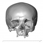 NGA88 SK830 Homo sapiens cranium anterior
