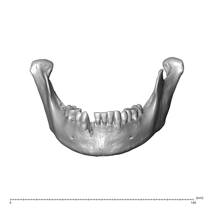 NGA88 SK860 Homo sapiens mandible anterior