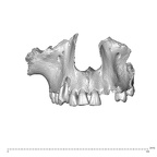 NGA88 SK860 Homo sapiens maxilla dentition anterior