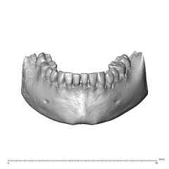 NGA88 SK889 Homo sapiens mandible dentition anterior