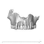 NGA88 SK889 Homo sapiens maxilla dentition anterior