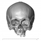 NGA88 SK917 Homo sapiens cranium anterior