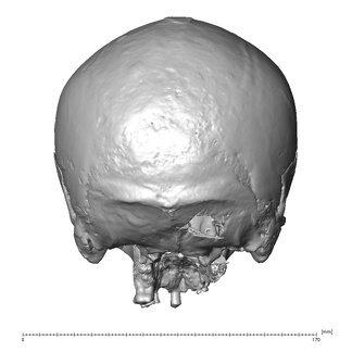 NGA88 SK917 Homo sapiens cranium posterior