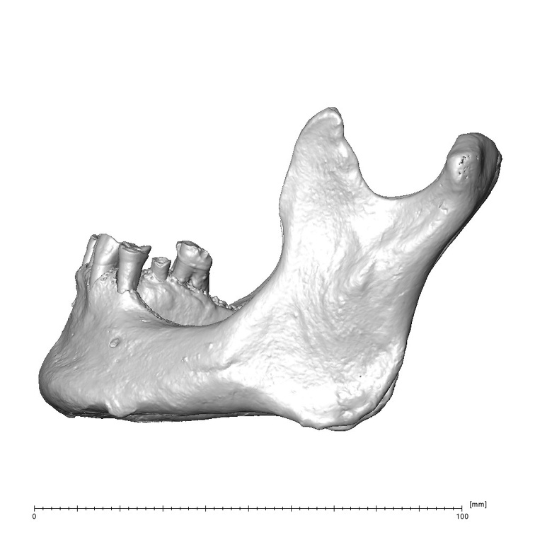 NGA88 SK917 Homo sapiens mandible lateral left