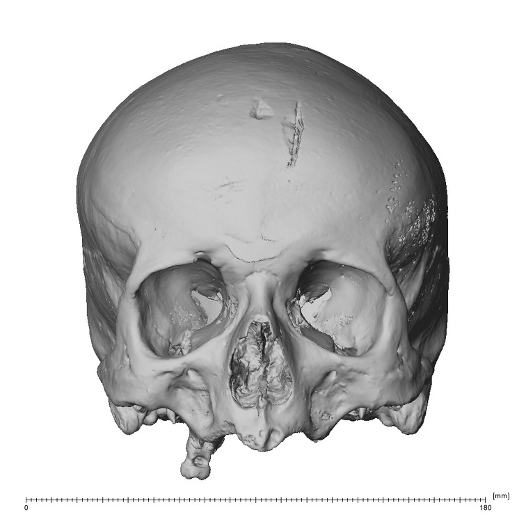 NGA88 SK919 Homo sapiens cranium anterior