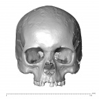 NGA88 SK932 H. sapiens cranium