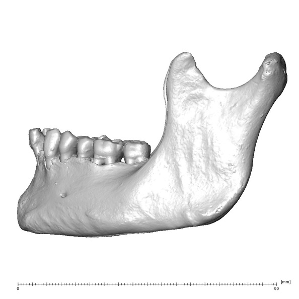NGA88 SK932 Homo sapiens mandible lateral left