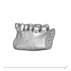NGA88 SK932 Homo sapiens mandible lateral