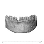 NGA88 SK977 Homo sapiens mand dent anterior