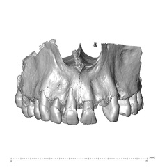 NGB89 SK22 Homo sapiens maxilla anterior