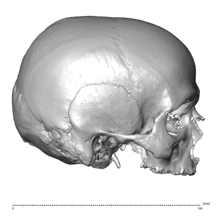 NGB89 SK36 Homo sapiens cranium lateral right