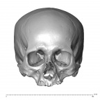 NGB89 SK4 Homo sapiens cranium anterior