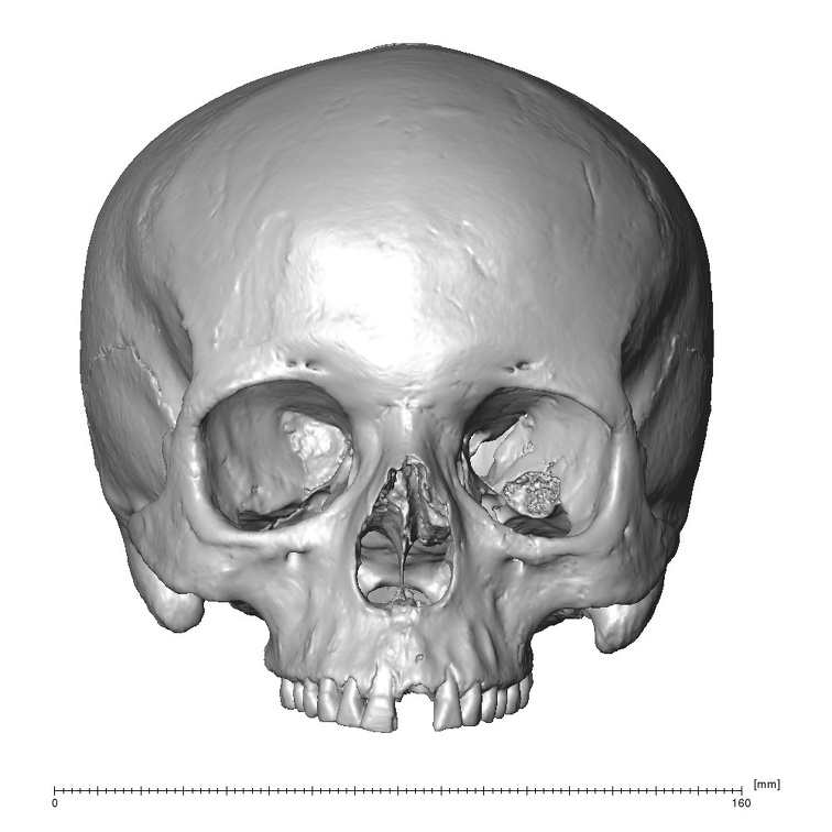 NGB89 SK52 Homo sapiens cranium anterior