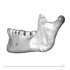 NGB89 SK52 Homo sapiens mandible lateral left