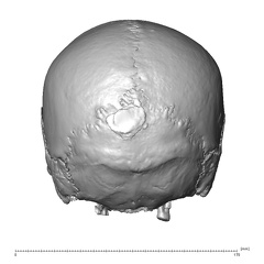 NGB89 SK6 Homo sapiens cranium posterior