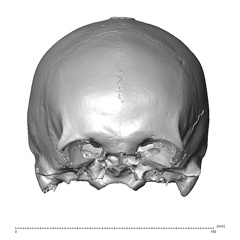 NGB89 SK72 Homo sapiens cranium anterior