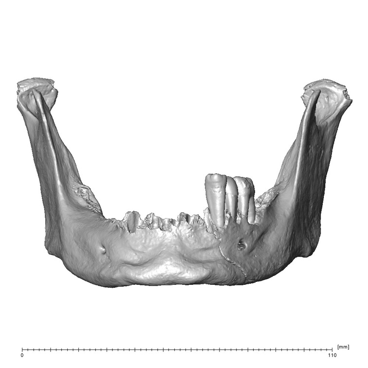 NGB89 SK72 Homo sapiens mandible anterior