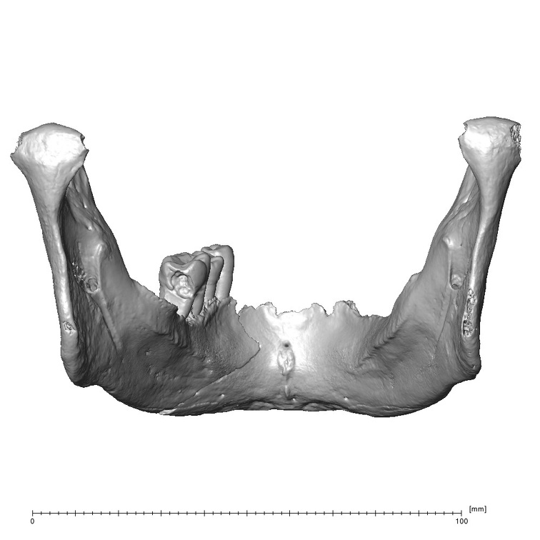 NGB89 SK72 Homo sapiens mandible posterior