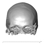 NGB89 SK73 Homo sapiens cranium anterior