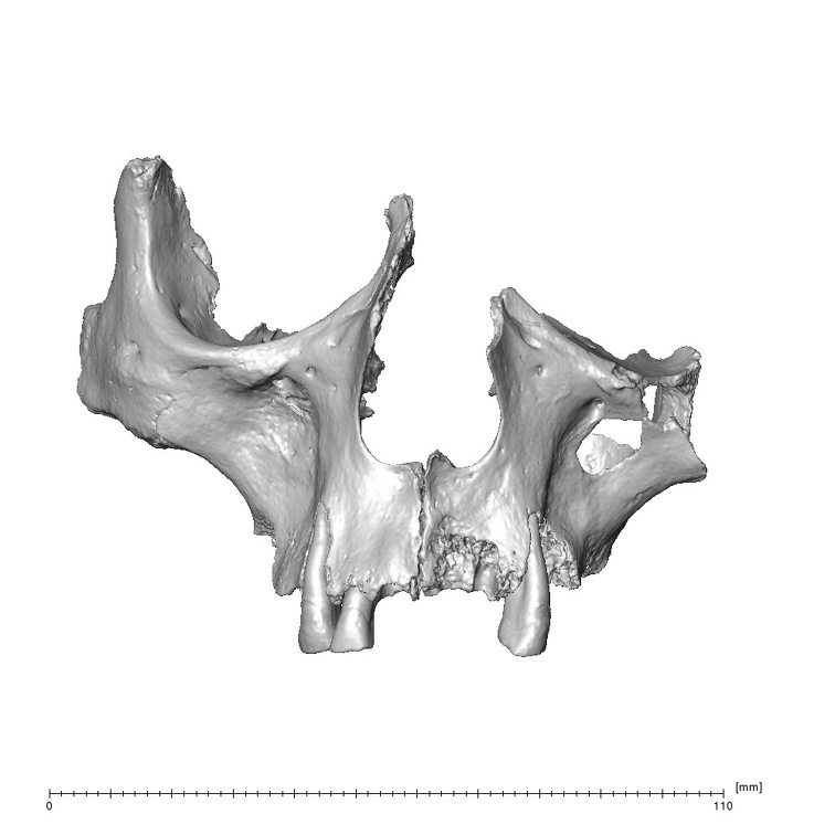 NGB89 SK73 Homo sapiens maxilla anterior
