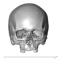 NGB89_SK81_Homo_sapiens_cranium_anterior.jpg