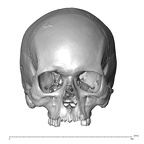 NGB89 SK81 H. sapiens cranium