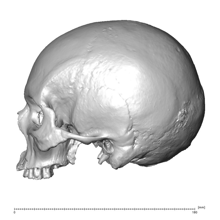 NGB89 SK81 Homo sapiens cranium lateral left