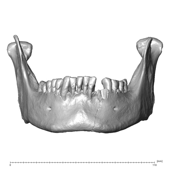 NGB89 SK81 Homo sapiens mandible anterior