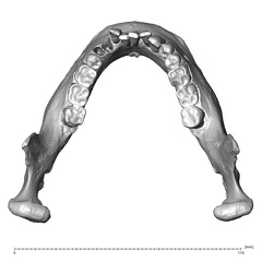 NGB89 SK81 Homo sapiens mandible superior