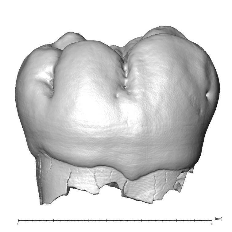 Engis 2 Homo neanderthalensis LRM1 buccal