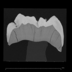 Engis 2 Homo neanderthalensis URM1 ct slice