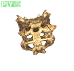 DNH 43A sacrum partial reconstruction