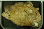 MLD 3a Australopithecus africanus endocast