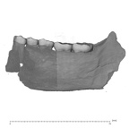 UW101-001+850 Homo naledi mandible medial