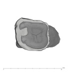 UW101-005 Homo naledi URM2 occlusal