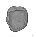 UW101-1002 Homo naledi LRM germ apical