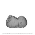 UW101-1002 Homo naledi LRM germ mesial