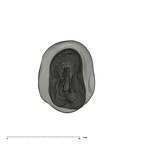 UW101-1004 Homo naledi UP apical